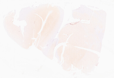 ['deident_3b7f6bd9-6c3b-490f-99ad-0731c7ff6dbb_69d966de.jpg']