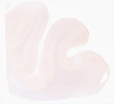 ['deident_11ed5662-c7b9-4c30-b6e0-8e8299f2a09f_69d966c3.jpg']