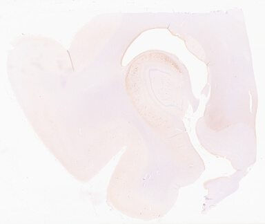 ['deident_bd4ac324-efea-40af-9c7e-b6c994e572aa_69d96727.jpg']