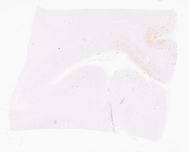 ['deident_f7e50f10-c6b2-4192-802a-7e8e80d340e8_69d9674e.jpg']