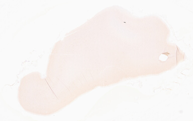 ['deident_feba6223-f390-444c-9ff4-31b03e299b8c_69d96751.jpg']