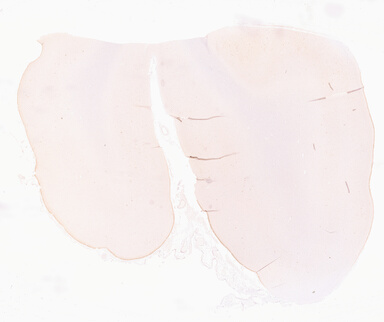 ['deident_51e6f860-ea25-483c-ad4d-15cd41b244d7_69d966f0.jpg']