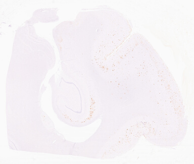 ['deident_28e261cf-dd76-4bbd-9456-59985313142e_69d966d3.jpg']