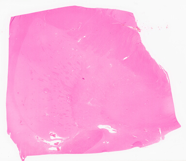 ['deident_7673702d-f437-4459-8f3c-dc089effb8fa_69d96705.jpg']