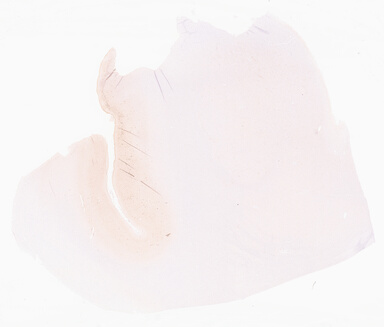 ['deident_2036f676-dbf7-4268-8388-032b2a53d9db_69d966ca.jpg']