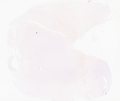 ['deident_f0aa4bb4-f61a-4ac4-85c4-2df5b754169a_69d9674c.jpg']