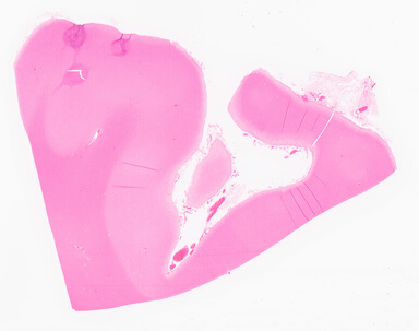 ['deident_d7b2499e-8d96-4d02-b66f-598796f99757_69d96739.jpg']