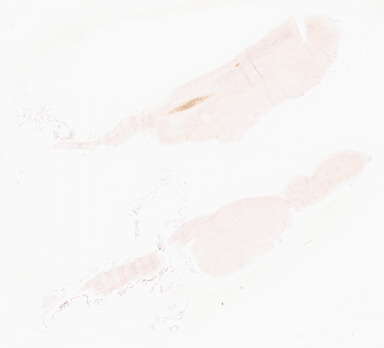 ['deident_7147be36-5d14-466a-8d12-44f066504503_69d966fe.jpg']