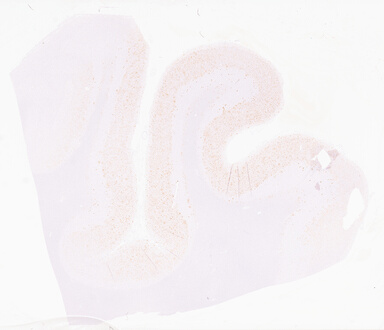 ['deident_15d1fd7a-69da-4b79-b006-d219766441a7_69d966c5.jpg']
