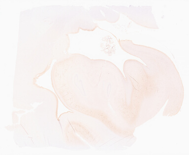 ['deident_227c33b9-8931-428b-8107-9b383e388eb3_69d966cb.jpg']