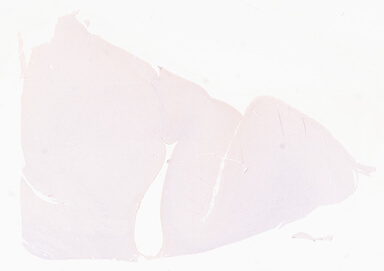 ['deident_d37f0778-7283-42ae-8bb8-a7dd557015a6_69d96735.jpg']