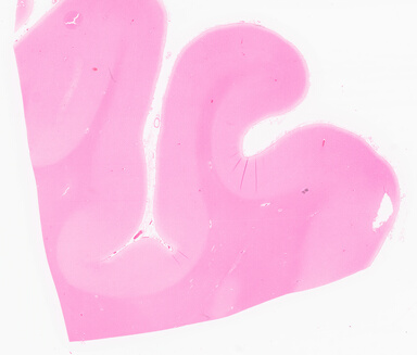 ['deident_70522251-89c3-418f-95b3-350d9a26bb38_69d966fd.jpg']