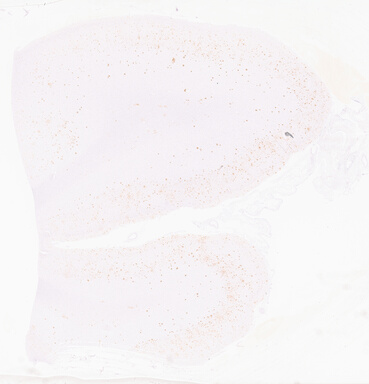 ['deident_26bd94f8-0b78-4227-a92b-6081219c5639_69d966cf.jpg']