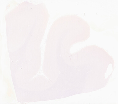['deident_d5f1ca2a-8077-4107-ac73-5d3649745220_69d96737.jpg']
