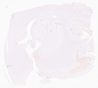 ['deident_2cf17eaf-60d6-49f1-89d4-d8a2f866d688_69d966d5.jpg']