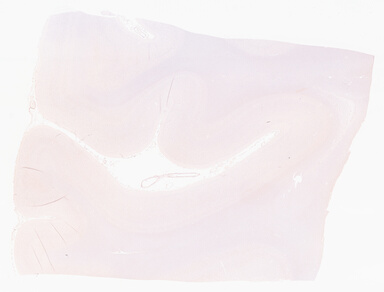 ['deident_ec323060-07cc-4742-84f6-544fa55748db_69d96746.jpg']