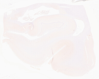 ['deident_7af38d63-ad04-48db-97be-674634420f22_69d9670b.jpg']