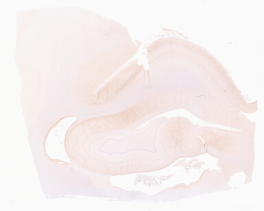 ['deident_94b232e6-e440-4404-bc82-51801c216a83_69d9671a.jpg']