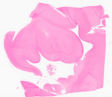 ['deident_fc4b408a-bc93-437d-9f56-97205edf6a0d_69d9674f.jpg']