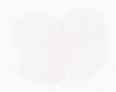 ['deident_e885c176-e814-4ed1-8405-1ce95e8a73ee_69d96743.jpg']