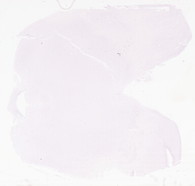 ['deident_c16c99dd-0225-4572-95e3-cf958db53cb0_69d9672c.jpg']