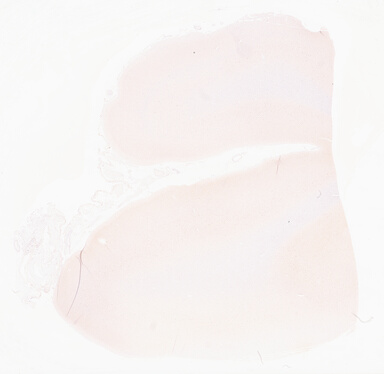 ['deident_8a8bc1e7-38be-4f4f-aef8-c2c7e8a9e643_69d96712.jpg']