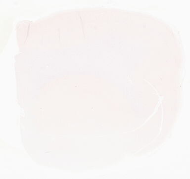 ['deident_43505a79-9d64-4c09-8ec6-b59760b26e70_69d966df.jpg']