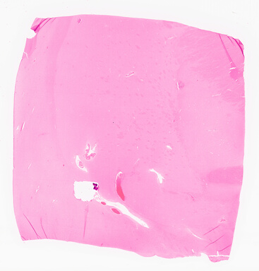 ['deident_1bd31744-4cca-4c20-87da-8e6408a3e104_69d966c8.jpg']