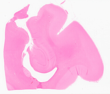 ['deident_4432bc33-3181-4490-9be3-b8dfad9bd141_69d966e1.jpg']