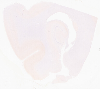 ['deident_62e18b90-c84e-4022-9c5e-82b21a71cc59_69d966f9.jpg']
