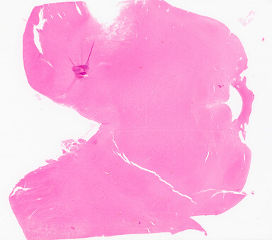['deident_489af970-a83c-4e76-8e36-d8fcfefcb293_69d966e6.jpg']