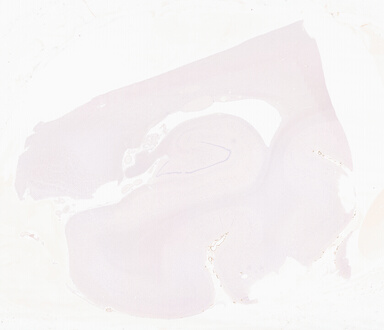['deident_f13e0042-e72c-4417-ba48-f7be93250bde_69d941c4.jpg']