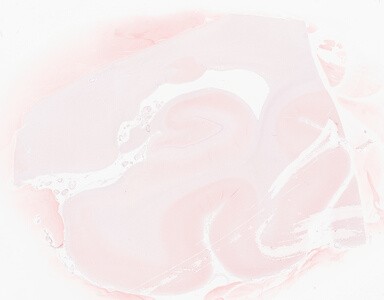 ['deident_b795b9f5-9c8f-4a3d-8d7c-ad5ed37680ed_69d9419a.jpg']