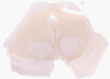 ['deident_adde39d4-f466-4a0d-ae42-241b985ad18c_69d94193.jpg']
