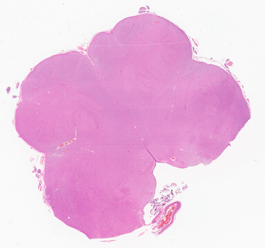 ['deident_dea69b2b-3b5d-4600-b37f-cf0cd4cb3b8f_69d941b4.jpg']