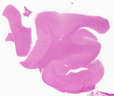 ['deident_f395130f-0f70-4b0d-8c06-386ae05fe5fd_69d941c6.jpg']