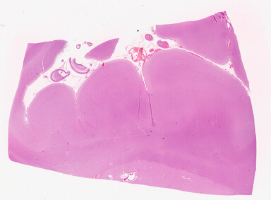 ['deident_dc4abaa8-7473-4a53-8420-909508e4dea9_69d941b2.jpg']