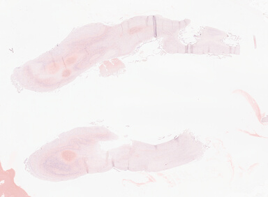 ['deident_ca938ed1-0baf-42a3-a4af-d6eb5a9eeb9b_69d941a7.jpg']