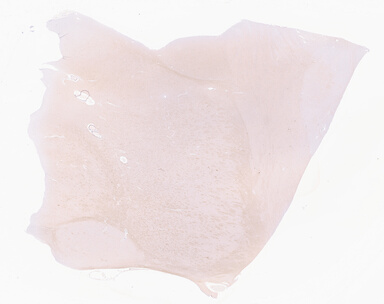 ['deident_a15e4395-fd07-44ba-801b-181543a230ab_69d9418e.jpg']