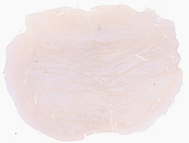 ['deident_649ae9c1-8d8a-41d2-954c-f3fbbf025fc2_69d9417b.jpg']