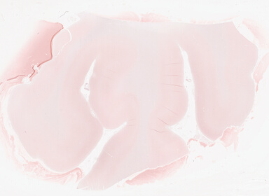['deident_b6d45045-fc9f-420f-8ed1-c7a990debd93_69d94198.jpg']