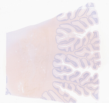 ['deident_ffd4071f-dcd3-4399-abfc-9ca0bc225ecb_69d941c8.jpg']