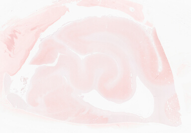 ['deident_5d85d131-1b6c-4cdb-b102-2b133d3f8abb_69d94177.jpg']