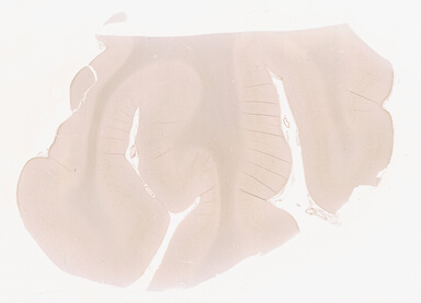 ['deident_ace01f77-9c93-4e8b-b0cc-b159ebe7a0a7_69d94191.jpg']