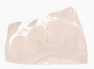 ['deident_143b149f-12c5-4526-b105-bf8dd6c805c8_69d94160.jpg']
