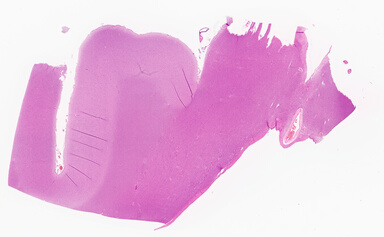 ['deident_e7de1153-a6bf-414d-a5f0-ee72c5bddfcb_69d941bd.jpg']