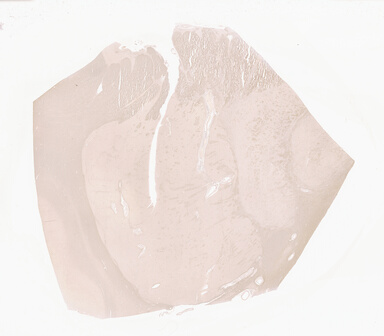 ['deident_e276c885-945a-4f05-9562-e8023971d1aa_69d941bb.jpg']