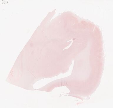['deident_8d89b051-1719-4d95-b574-f22794958d43_69d94186.jpg']
