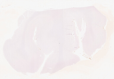 ['deident_e0be5ae3-9438-4b8a-aea8-627d0834e06b_69d941b8.jpg']