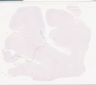 ['deident_ee923e7e-0b12-4619-a1de-44d5593e3c60_69d941c2.jpg']